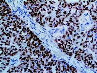 Estrogen Receptor (EP1), RMab MAIN