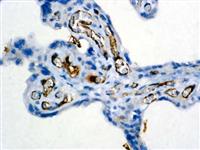 Factor VIII-Related Antigen (Polyclonal), RPab MAIN