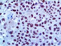 Fli-1 (G146-222), MMab MAIN