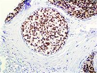 FOXA1 / HNF-3A (Polyclonal), RPab MAIN