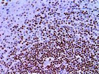 FOXO1 (EP290), RMab MAIN