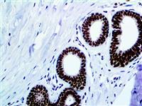 FOXP1 (EP137), RMab MAIN