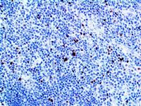 FOXP3 (Polyclonal), RPab MAIN