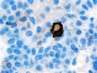 FSH (BSB-55), MMab MAIN