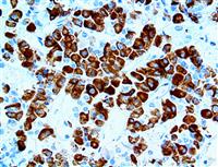 FSH (EP257), RMab MAIN