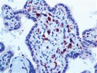 Factor XIIIa (EP292), RMab MAIN