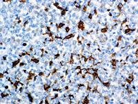 Fascin (BSB-36), MMab MAIN