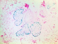 TintoFast Androgen Receptor (BSB-4), MMab MAIN