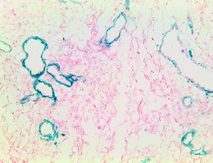 TintoFast NGFR (BSB-18), MMab MAIN