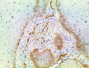 TintoFast Podoplanin (D2-40), MMab MAIN