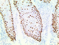 TintoFast p40 (ZR8), RMab MAIN