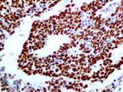 GATA-3 (L50-823), MMab THUMBNAIL