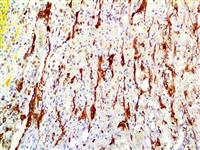 GFAP (RM246), RMab MAIN