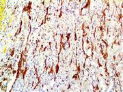 GFAP (RM246), RMab THUMBNAIL