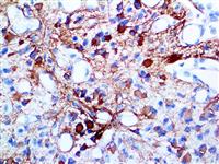 GFAP (G-A-5), MMab MAIN