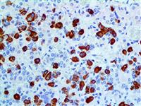 GH (EP267), RMab MAIN