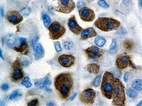 GH (BSB-99), MMab MAIN