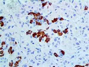 GH (Polyclonal), RPab MAIN