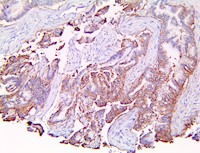 GLUT1 (RBT-GLUT1), RMab MAIN