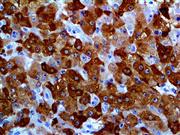Glutamine Synthetase (GS-6), MMab THUMBNAIL