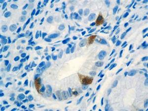 Gastrin (Polyclonal), RPab MAIN