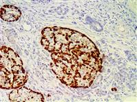 Glucagon (EP74), RMab MAIN