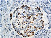 Glucagon (BSB-111), MMab THUMBNAIL