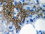 Glycophorin A (GA-R2 (HIR2)), MMab THUMBNAIL