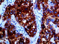 Glypican-3 (1G12), MMab MAIN