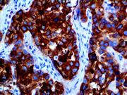 Glypican-3 (1G12), MMab THUMBNAIL