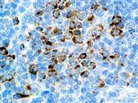 Granzyme B (EP230), RMab MAIN