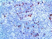 Granzyme B (Polyclonal), RPab THUMBNAIL