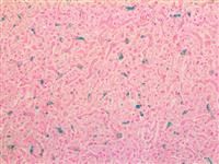 Macrophage / HAM-56 (HAM-56), MMab MAIN