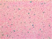 Macrophage / HAM-56 (HAM-56), MMab THUMBNAIL