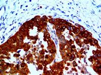 HE4 (EP370), RMab MAIN