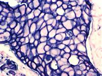 HER-2 neu (BSB-3), MMab MAIN