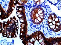 HER-3 / c-erbB-3 (RBT-HER3), RMab MAIN