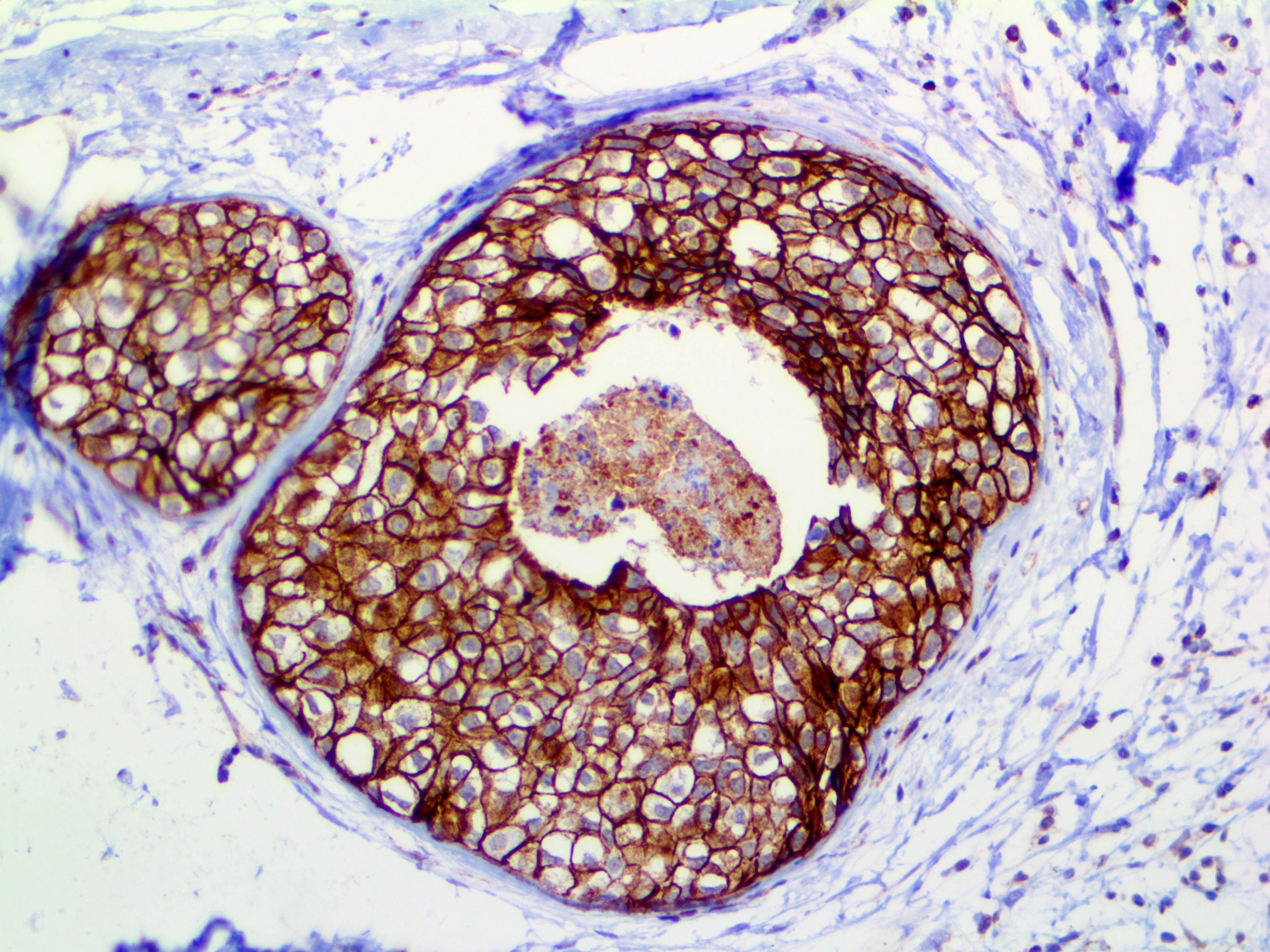 HER2 neu Phospho (EP123), RMab MAIN