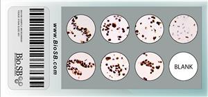 7-Core HPV Cervical Cancer Cell Line Microarray MAIN