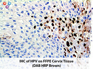 PolyDetector DAB HRP Brown Chromogen MAIN