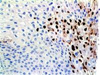 HPV (BSB-66), MMab MAIN