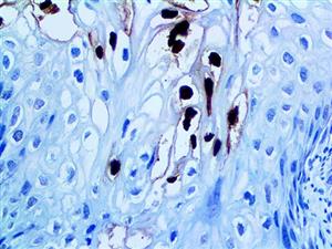 HPV16 (CAMVIR-1), MMab MAIN