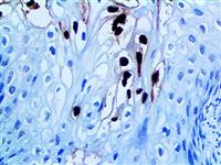 HPV16 (CAMVIR-1), MMab MAIN