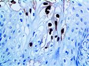 HPV16 (CAMVIR-1), MMab THUMBNAIL