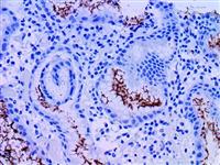Helicobacter Pylori (EP279), RMab MAIN