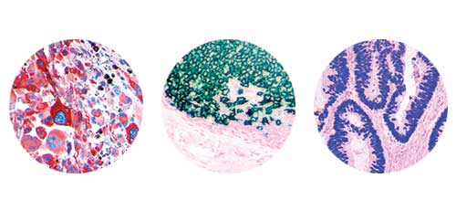 HRP Chromogens