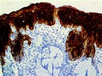 HSP-27 (G3.1), MMab MAIN