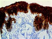 HSP-27 (G3.1), MMab THUMBNAIL