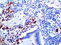 Herpes Simplex Virus I (10A3), MMab MAIN