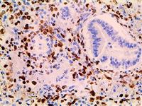 Herpes Simplex Virus I & II (10A3 & BSB-116), MMab MAIN